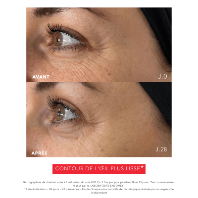 EYE C+ |Revitalizing anti-aging eye care Before/After |Laboratoire ENEOMEY