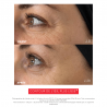EYE C+ |Revitalizing anti-aging eye care Before/After |Laboratoire ENEOMEY