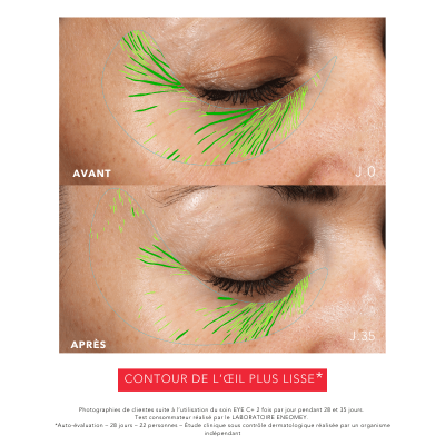 EYE C+ |Revitalizing anti-aging eye care Before/After |Laboratoire ENEOMEY