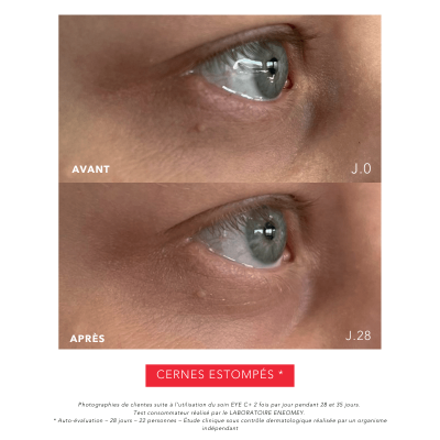 EYE C+ |Revitalizing anti-aging eye care Before/After |Laboratoire ENEOMEY