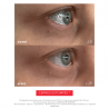 EYE C+ |Revitalizing anti-aging eye care Before/After |Laboratoire ENEOMEY